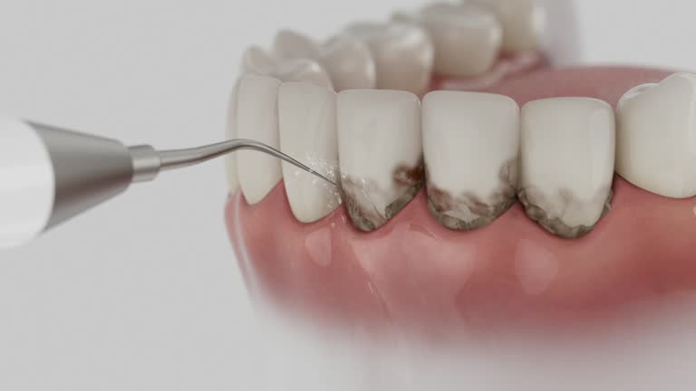Reliable Emergency Dentist contractor in Winfield, AL by Smile Center Dentistry